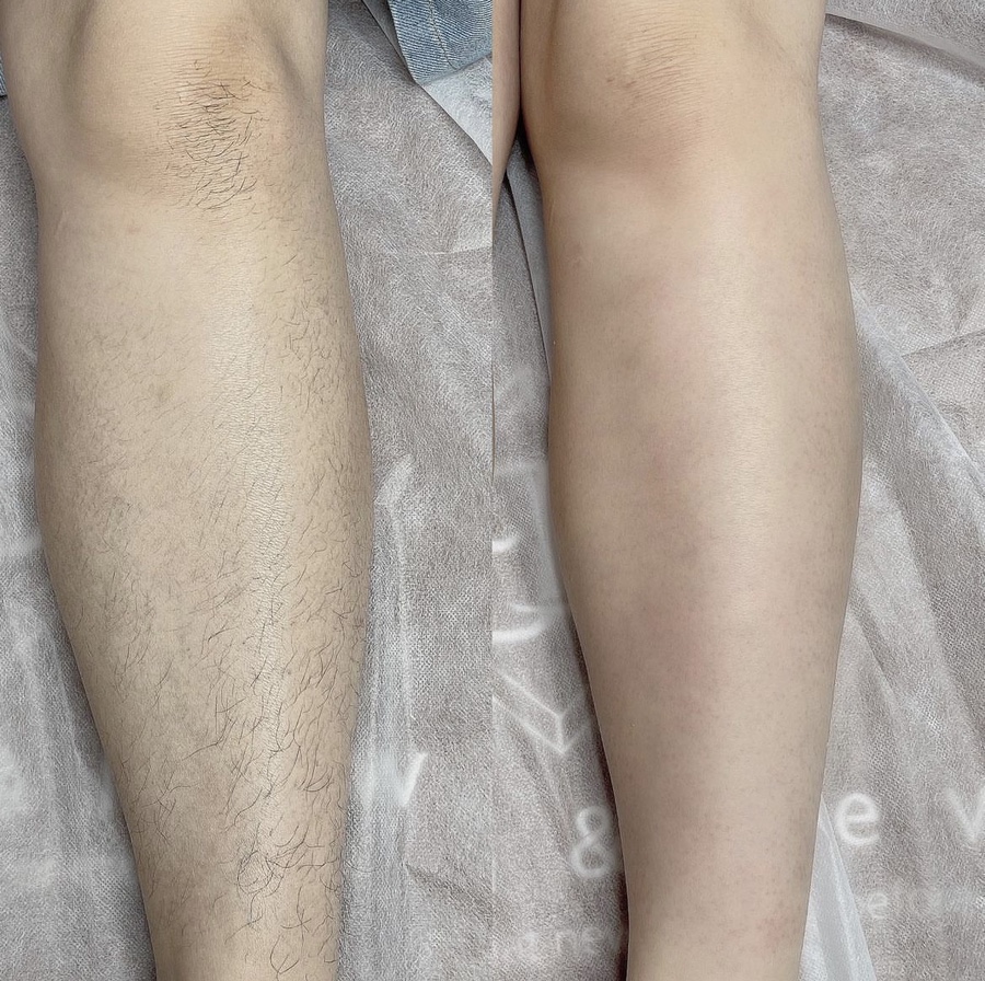 뷰앤뉴 이미지