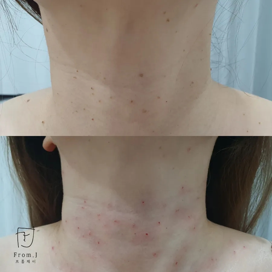 일산실면도 이미지