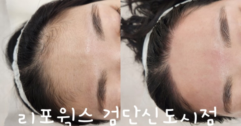 리포윅스 슈가링왁싱 검단신도시점 이미지