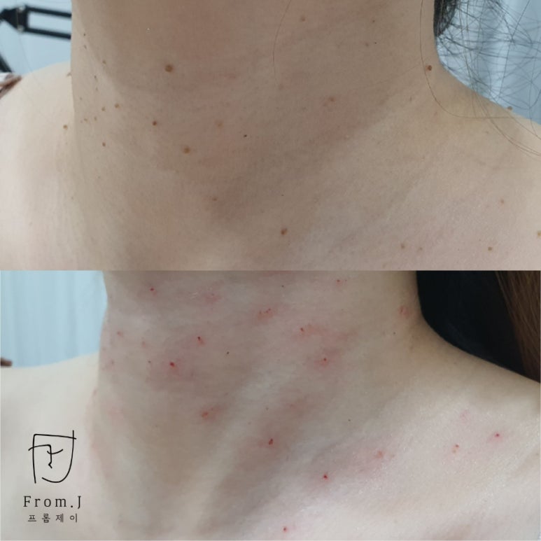 일산실면도 이미지