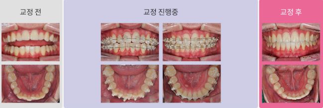 한미치과 이미지