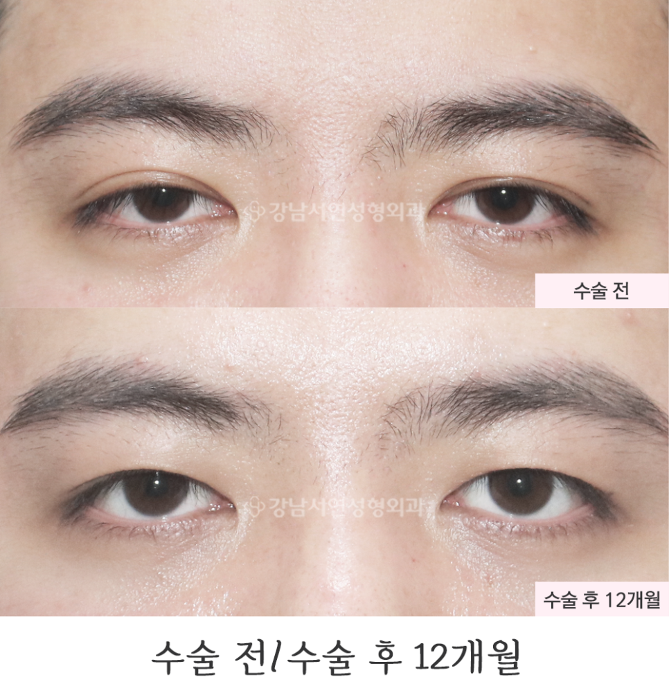 서연성형외과의원 이미지