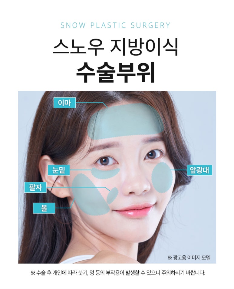 스노우의원 이미지