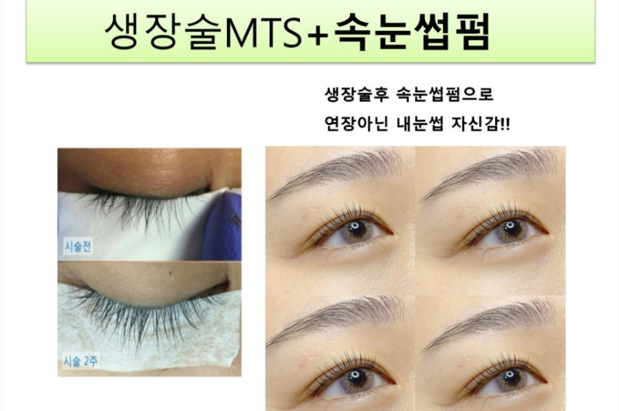 티제이 이미지