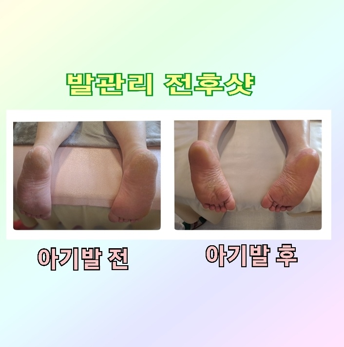 한방발관리 이미지