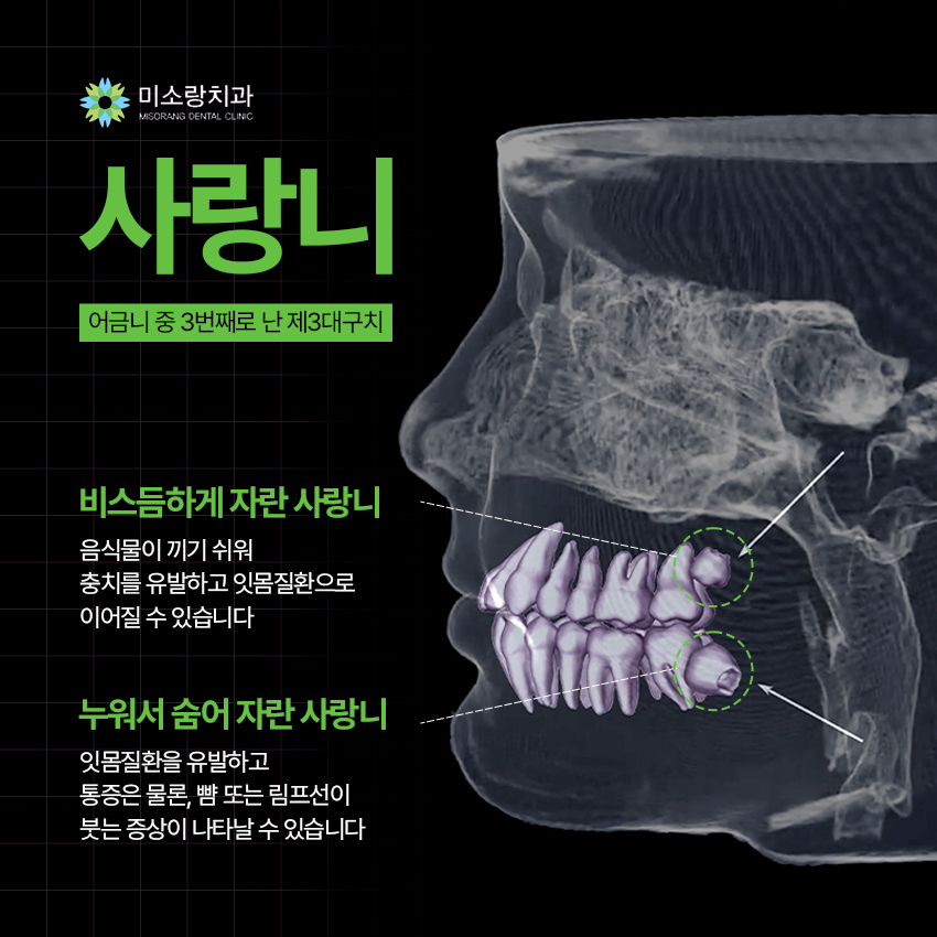 강남사랑니치과의원 이미지