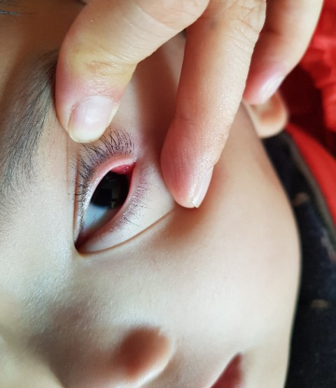 라파전위 이미지