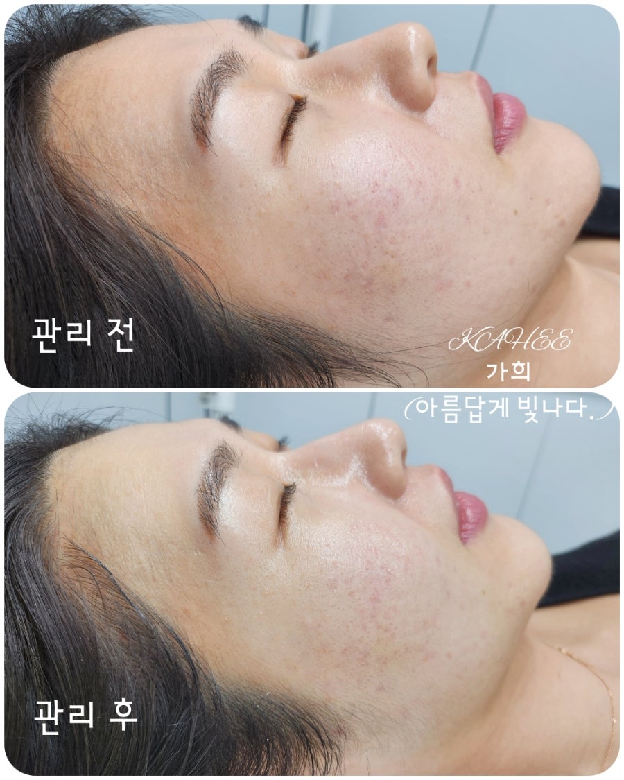 가희에스테틱 이미지