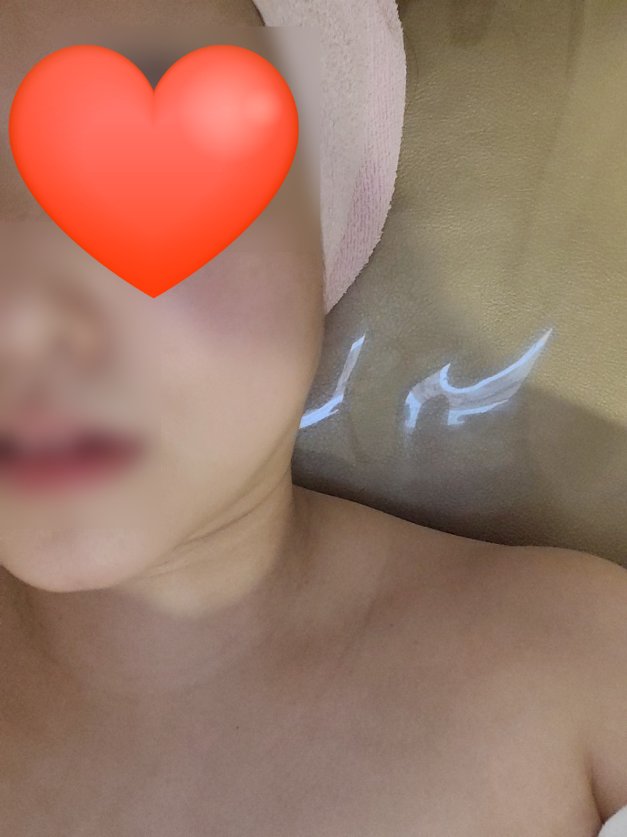 라멘떼에스테틱 이미지