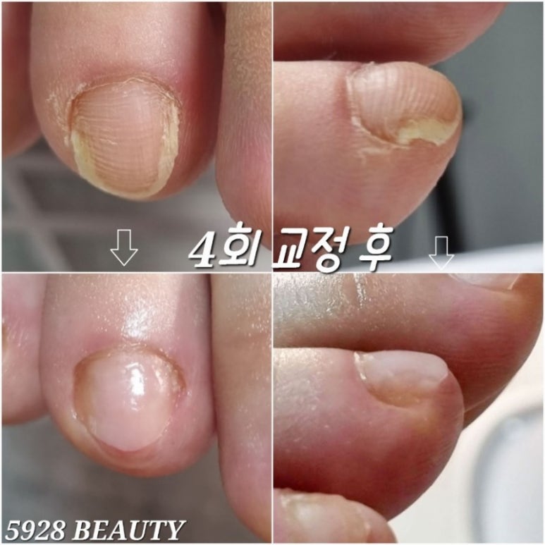 5928뷰티 이미지