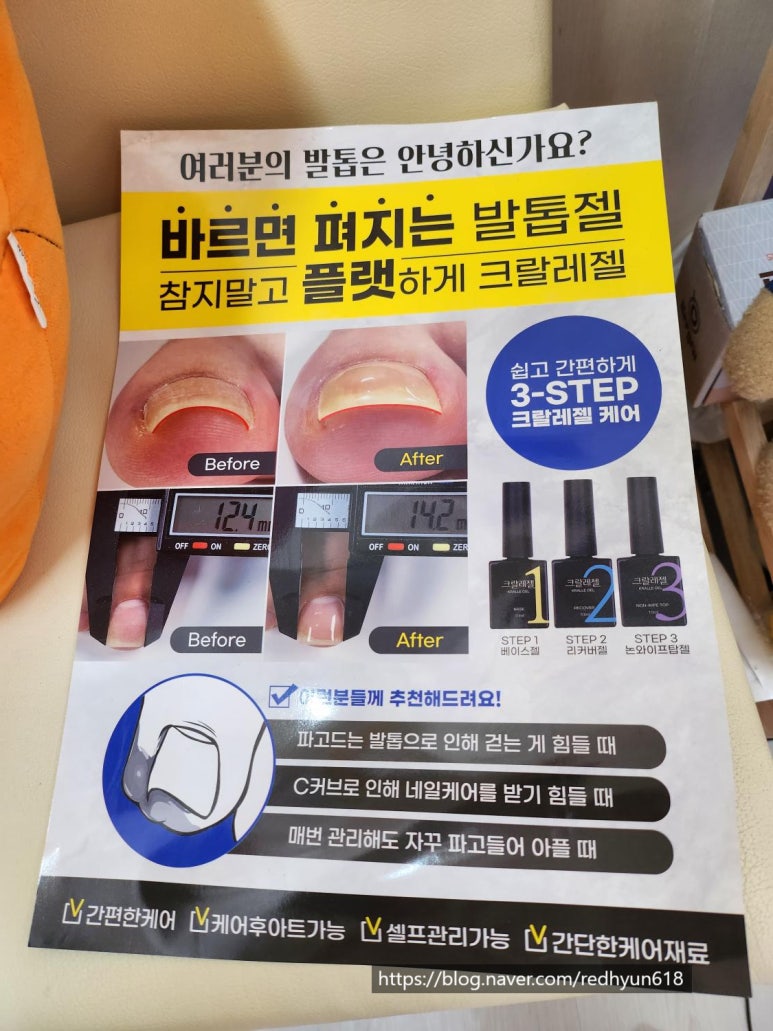 알미네일 이미지
