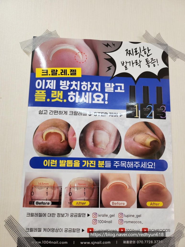 알미네일 이미지