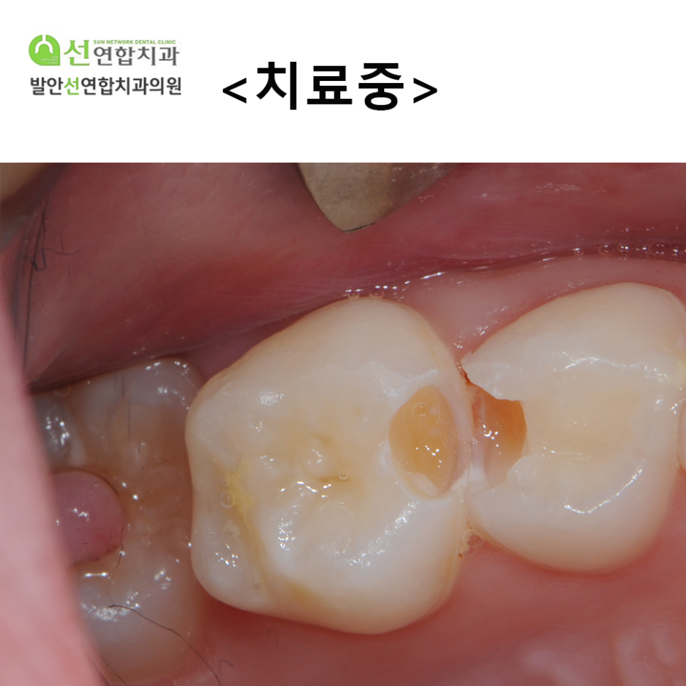 발안선연합치과 이미지