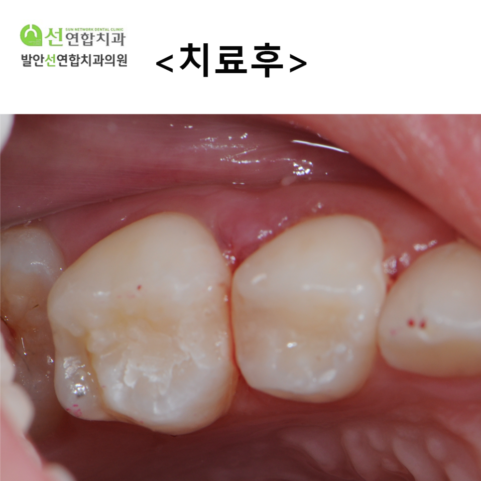 발안선연합치과 이미지