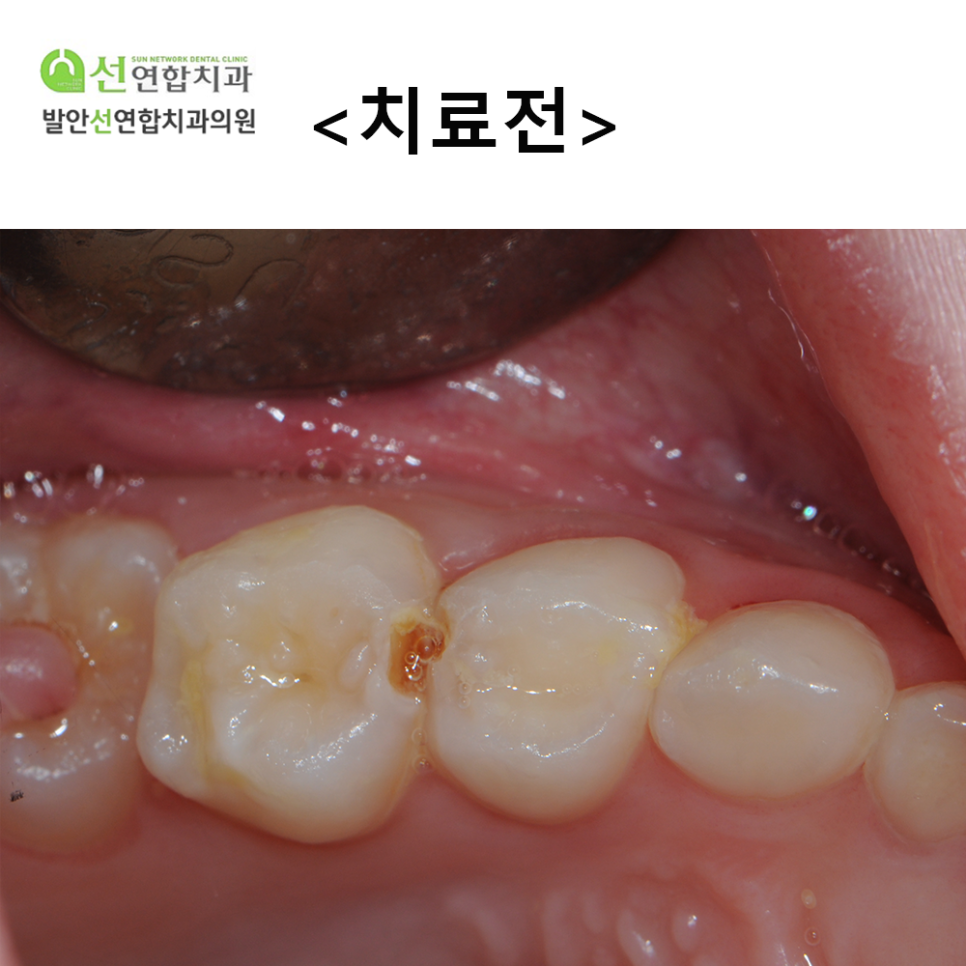 발안선연합치과 이미지