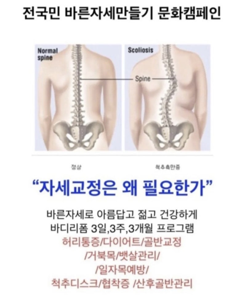 슬리밍고 이미지