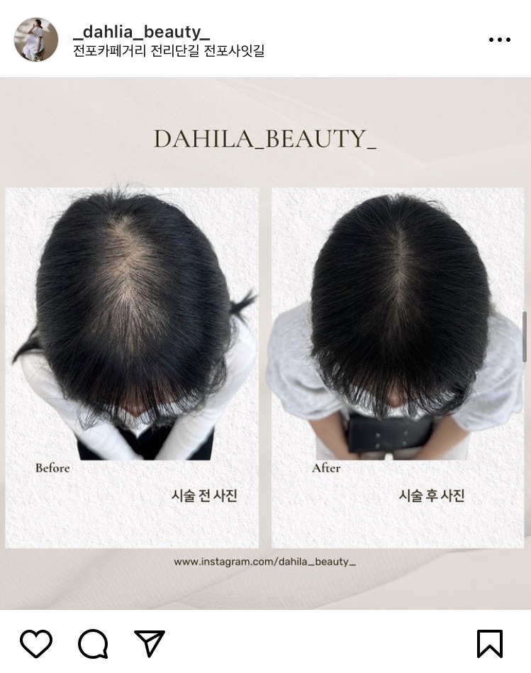으내뷰티 이미지