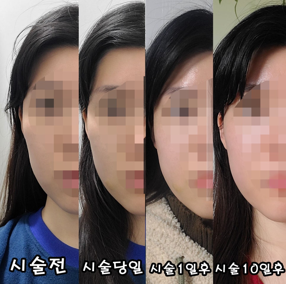 뷰티라인성형외과의원 이미지