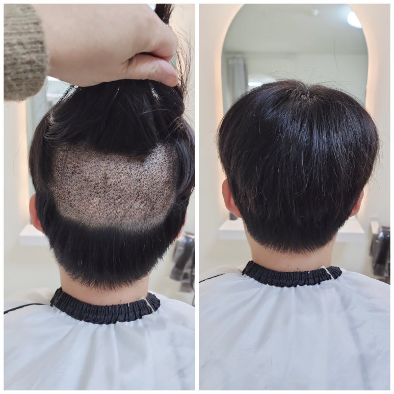 모모즈헤어&증모 이미지