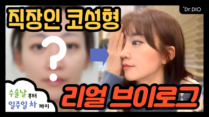 디오ENG 이미지