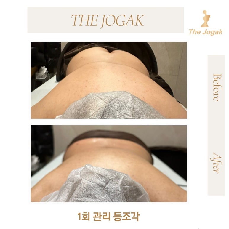 더조각테라피 이미지