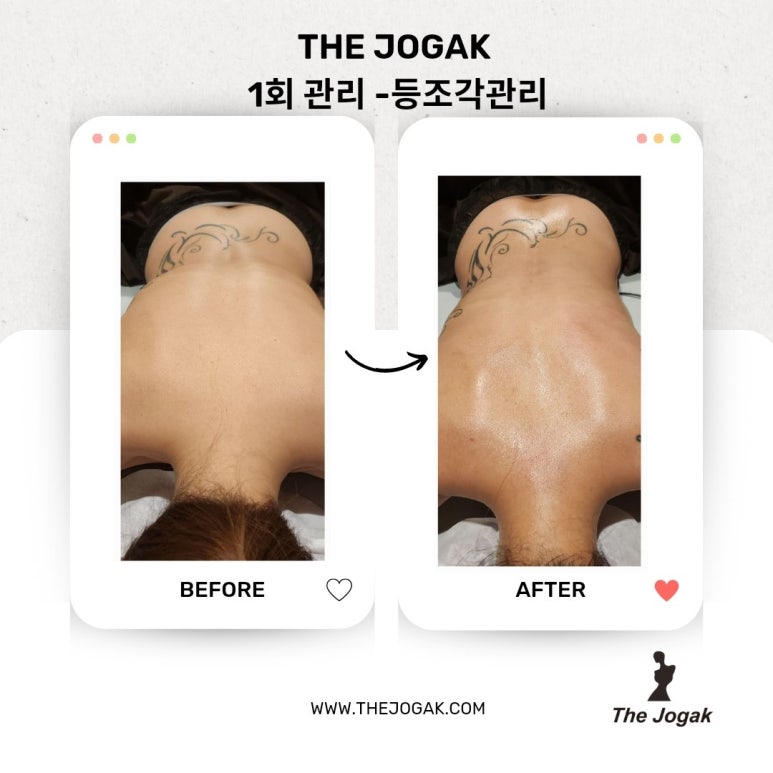 더조각테라피 이미지