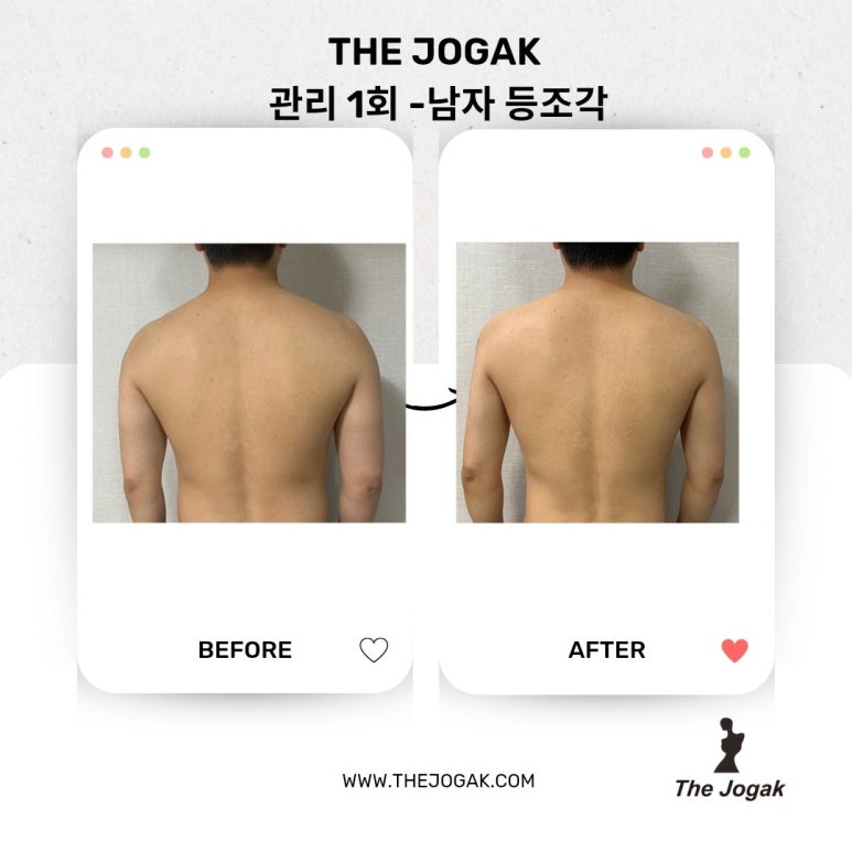 더조각테라피 이미지