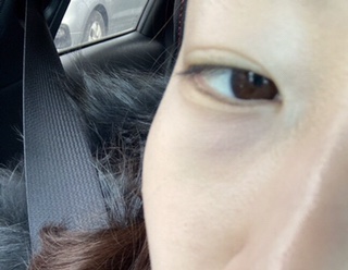 에이피에스테틱 이미지