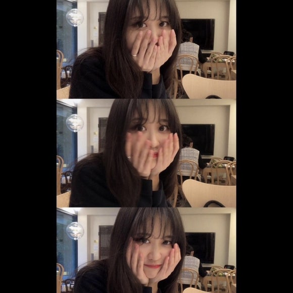 류헤어라인 이미지