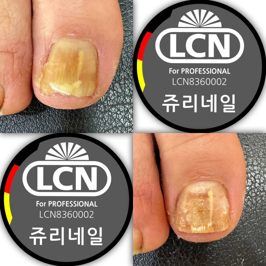 쥬리네일 이미지
