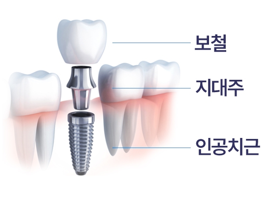 시카고치과의원 이미지