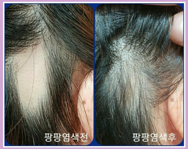 큐사랑염색 이미지