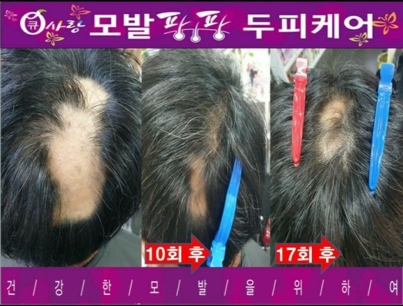 큐사랑염색 이미지