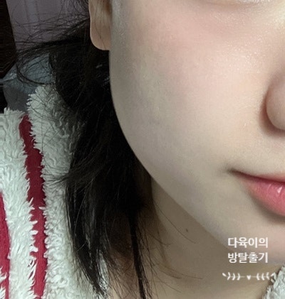 깨순이뷰티 이미지
