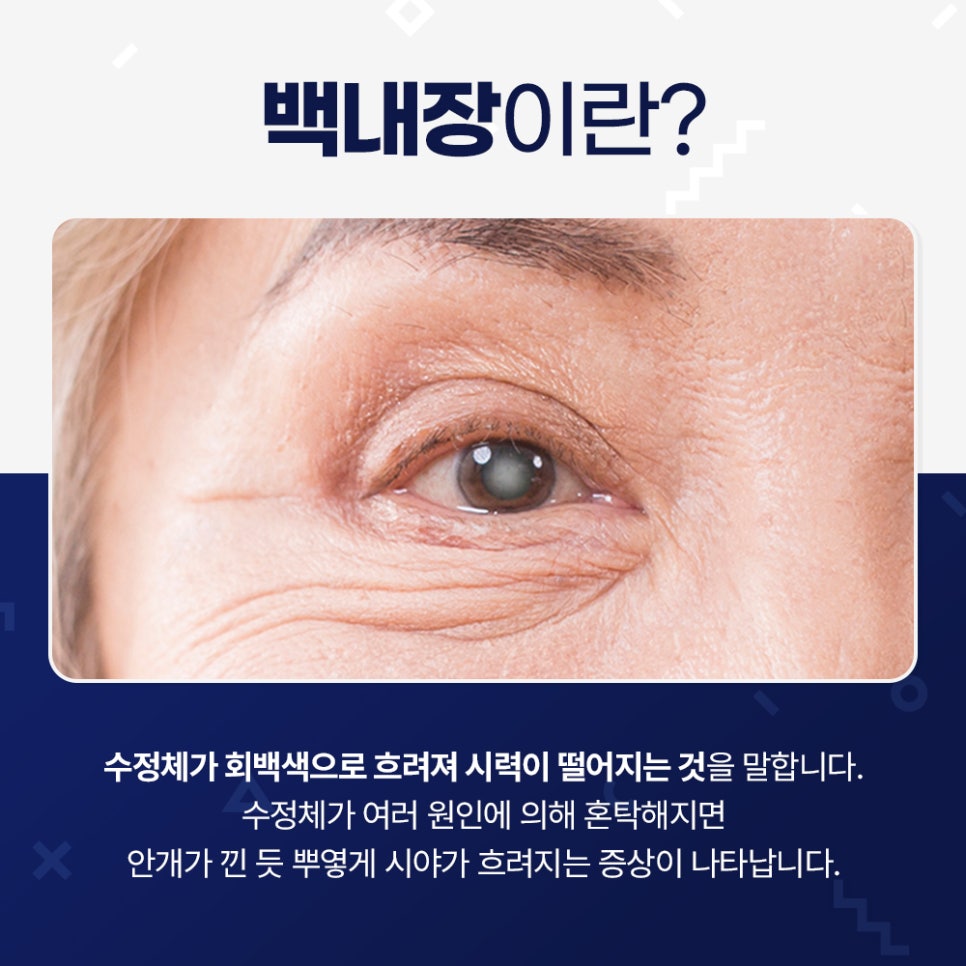 예스안과 이미지
