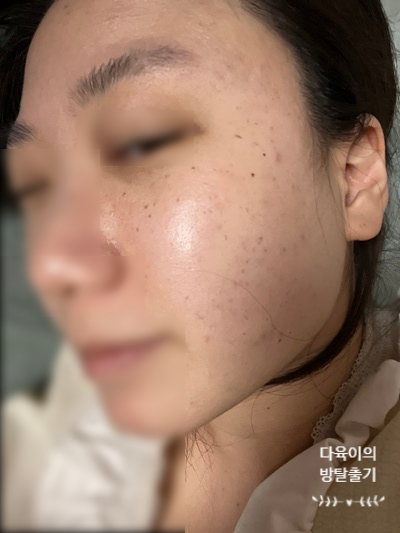 깨순이뷰티 이미지