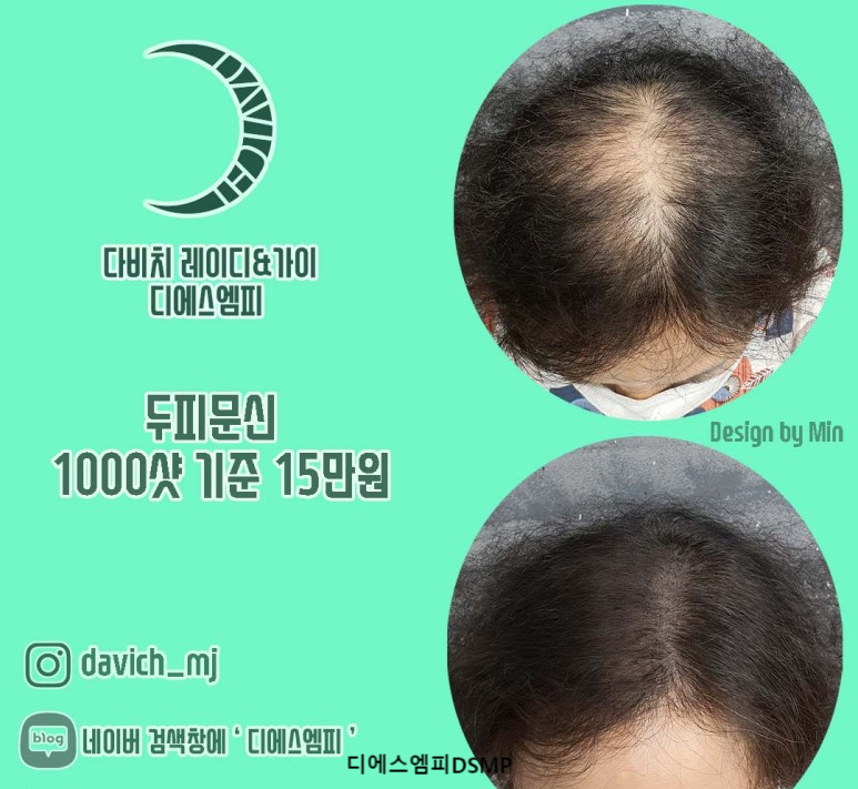 디에스엠피 이미지