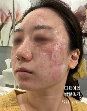 깨순이뷰티 이미지