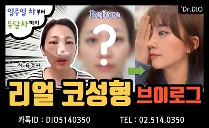 디오ENG 이미지