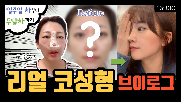 디오ENG 이미지