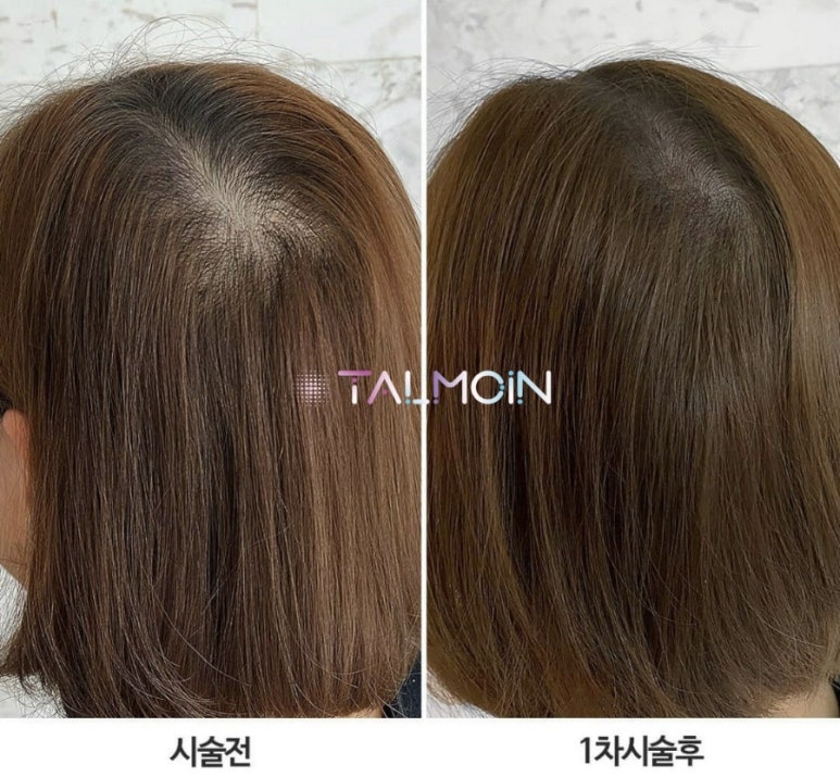 골드핑거네일 이미지