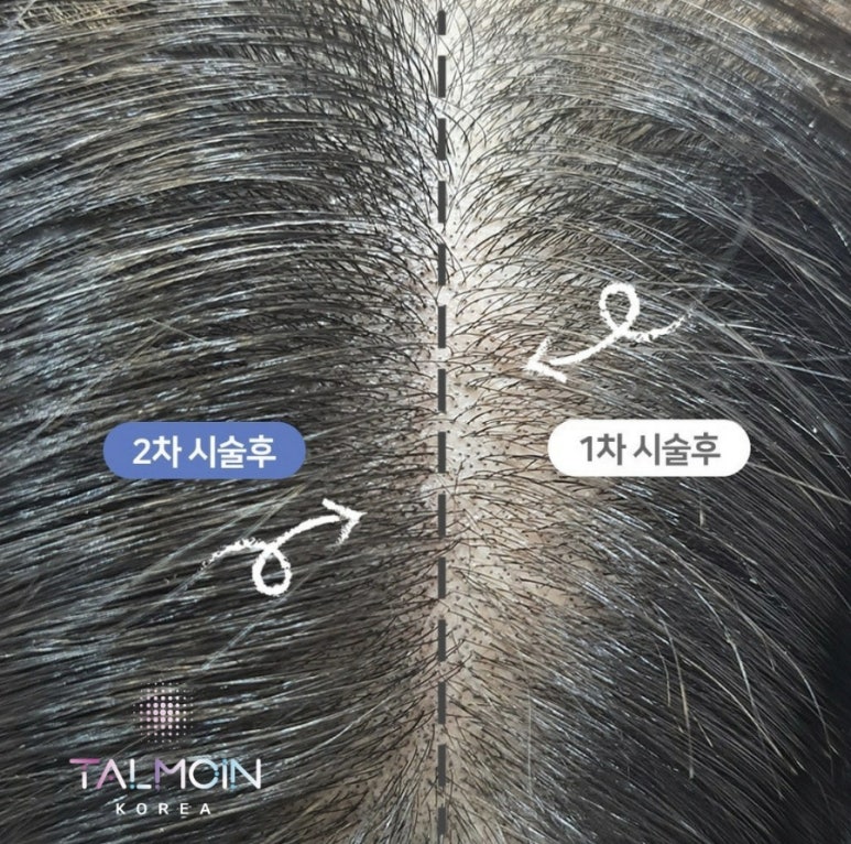 골드핑거네일 이미지