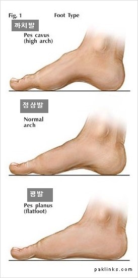 엔브이 이미지