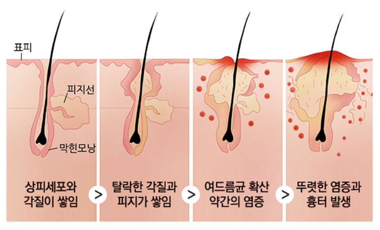 루시아스킨케어 이미지