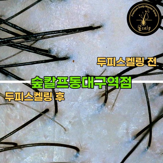 숲칼프 동대구역점 이미지