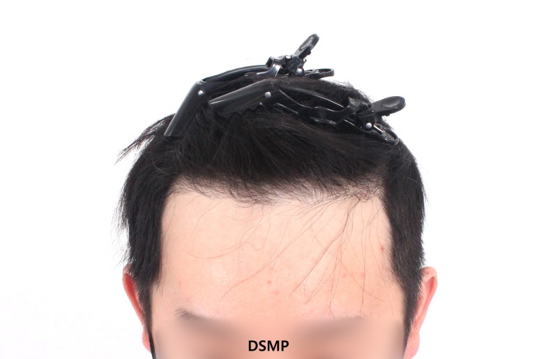 두피앤헤어 이미지