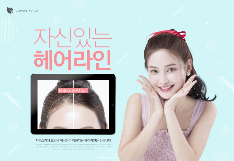 진헤어라인 이미지