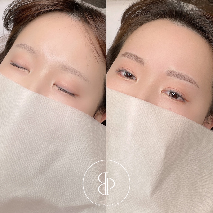 비프리티 이미지