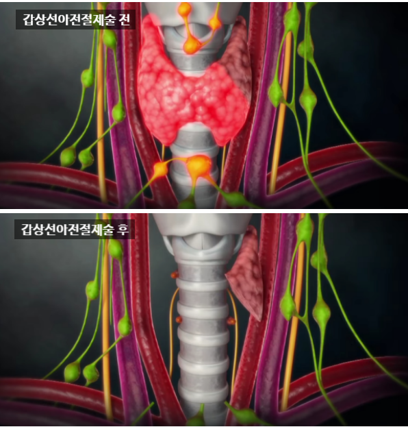 이내선아 이미지