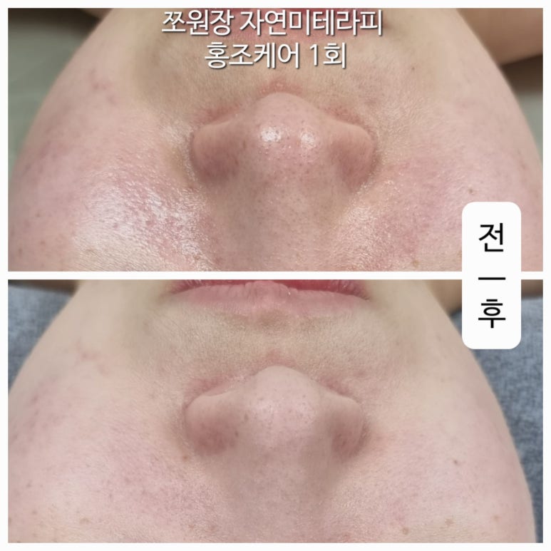 자연미피부바디 이미지
